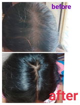 Anonymous review photo