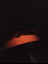 Anonymous review photo