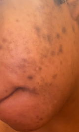 Anonymous review photo