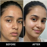Yogita review photo