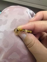 Anonymous review photo