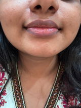 Kanga review photo