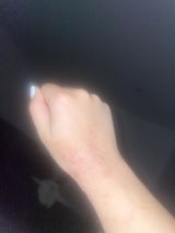 Anonymous review photo