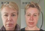 Beate review photo