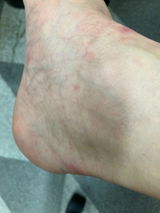 匿名 review photo