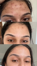Rachna Bhatia review photo