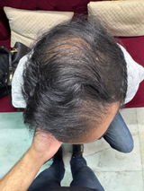 Ankur review photo