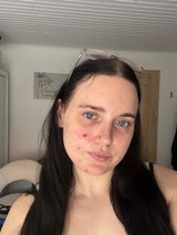 Anesa review photo