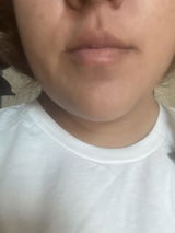 Alexis review photo