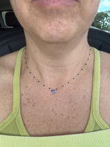 Anonymous review photo