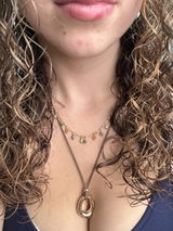 Anonymous review photo