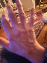 Anonymous review photo