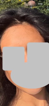Anonymous review photo