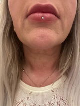 Göte review photo