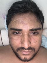 Anonymous review photo