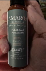 Anonymous review photo
