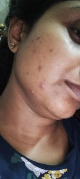 Anonymous review photo