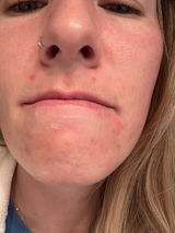 RP review photo