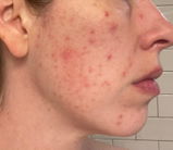 Lindsey review photo
