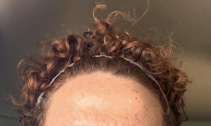 Tratamiento de Aclarado Progresivo ANHELI