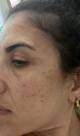 Mira Sarkis review photo