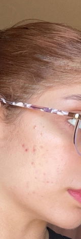 Farah review photo