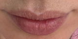 Before-after review photo