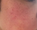 Anonymous review photo