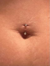 Vena review photo
