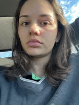 Anonymous review photo