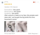 ¡*****| (Shopee Review) review photo