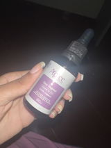 Ana review photo