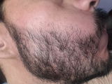 Luis Fernando Aguirre review photo