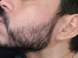 Luis Fernando Aguirre review photo