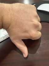 Anonymous review photo