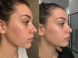 Dina review photo