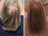 Chloe B. review photo