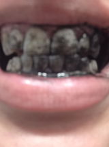 Ramon review photo