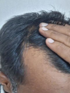 Review picture