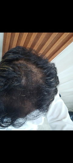 Review picture