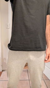 Anthony review photo