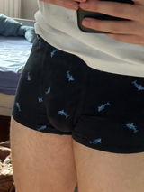 Anonymous review photo