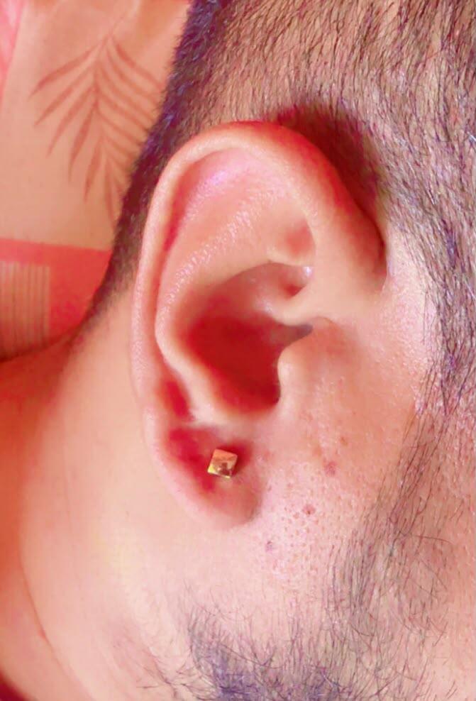 Anand G. review photo