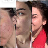 Bruna review photo