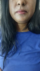 Anonymous review photo
