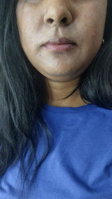 Anonymous review photo