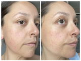 Denise review photo