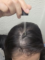 chin review photo