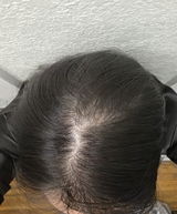 chin review photo
