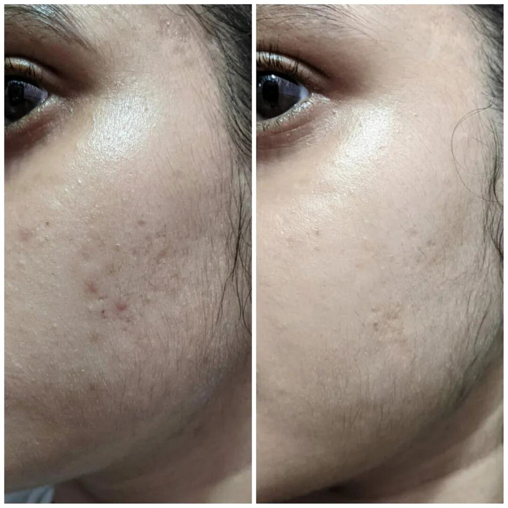 Customer review photo from Sumbal
